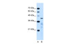 Antibody used in WB on Human Jurkat 0.25 ug/ml.