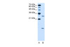 Antibody used in WB on Human HepG2 at 5.0 ug/ml.
