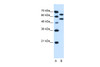 Antibody used in WB on Human HepG2 at 0.25 ug/ml.