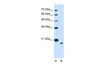 Antibody used in WB on Human HepG2 at 1.25 ug/ml.