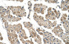 Antibody used in IHC on Human Muscle.