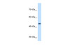 Antibody used in WB on Human Jurkat 1 ug/ml.