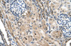 Antibody used in IHC on Human kidney.