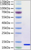 SARS-CoV-2 (COVID-19) envelope recombinant protein was determined by SDS-PAGE with Coomassie Blue, showing a band at 12 kDa.