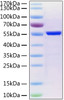 SARS-CoV-2 (COVID-19) nucleocapsid recombinant protein was determined by SDS-PAGE with Coomassie Blue, showing a band at 55 kD.
