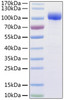 Human ACE2 recombinant protein was determined by SDS-PAGE with Coomassie Blue, showing a band at 95-110 kD.