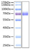 SARS-CoV-2 (COVID-19) spike S2 ECD recombinant protein was determined by SDS-PAGE with Coomassie Blue, showing a band at 70 kD.