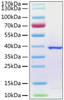 SARS-CoV-2 (COVID-19) papain-like protease was determined by SDS-PAGE with Coomassie Blue, showing a band at 38 kDa.