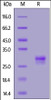 Human TL1A, His Tag on SDS-PAGE under reducing (R) condition. The gel was stained overnight with Coomassie Blue. The purity of the protein is greater than 90%.