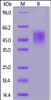 Mouse FGFR2 (IIIb) , His Tag on SDS-PAGE under reducing (R) condition. The gel was stained overnight with Coomassie Blue. The purity of the protein is greater than 90%.