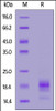 Rabbit IL-5, His Tag on SDS-PAGE under reducing (R) condition. The gel was stained overnight with Coomassie Blue. The purity of the protein is greater than 90%.