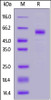 Human TREM2, Fc Tag on SDS-PAGE under reducing (R) condition. The gel was stained overnight with Coomassie Blue. The purity of the protein is greater than 95%.