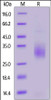 Cynomolgus TREM2, His Tag on SDS-PAGE under reducing (R) condition. The gel was stained overnight with Coomassie Blue. The purity of the protein is greater than 90%.