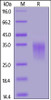 Rat 4-1BB, His Tag on SDS-PAGE under reducing (R) condition. The gel was stained overnight with Coomassie Blue. The purity of the protein is greater than 90%.