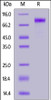 Human LIV-1, Fc Tag on SDS-PAGE under reducing (R) condition. The gel was stained overnight with Coomassie Blue. The purity of the protein is greater than 95%.