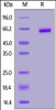 Human PLGF (19-221) , Fc Tag on SDS-PAGE under reducing (R) condition. The gel was stained overnight with Coomassie Blue. The purity of the protein is greater than 95%.