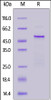 HCoV-229E Nucleocapsid, His Tag on SDS-PAGE under reducing (R) condition. The gel was stained overnight with Coomassie Blue. The purity of the protein is greater than 90%.
