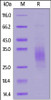 Biotinylated Human TREM2, His, Avitag™ on SDS-PAGE under reducing (R) condition. The gel was stained overnight with Coomassie Blue. The purity of the protein is greater than 90%.