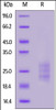 Mouse IL-33, His Tag on SDS-PAGE under reducing (R) condition. The gel was stained overnight with Coomassie Blue. The purity of the protein is greater than 90%.