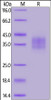 Cynomolgus FOLR2, His Tag on SDS-PAGE under reducing (R) condition. The gel was stained overnight with Coomassie Blue. The purity of the protein is greater than 90%.