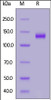 Human Netrin receptor DCC, His Tag on SDS-PAGE under reducing (R) condition. The gel was stained overnight with Coomassie Blue. The purity of the protein is greater than 95%.