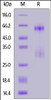 SARS-CoV-2 Nucleocapsid protein, His Tag on SDS-PAGE under reducing (R) condition. The gel was stained overnight with Coomassie Blue. The purity of the protein is greater than 90%.