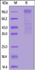 HCoV-HKU1 (isolate N5) S1 protein, His Tag on SDS-PAGE under reducing (R) condition. The gel was stained overnight with Coomassie Blue. The purity of the protein is greater than 90%.