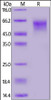 SARS-CoV-2 S1 protein NTD, His Tag on SDS-PAGE under reducing (R) condition. The gel was stained overnight with Coomassie Blue. The purity of the protein is greater than 90%.