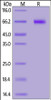 Mouse NOTCH1, His Tag on SDS-PAGE under reducing (R) condition. The gel was stained overnight with Coomassie Blue. The purity of the protein is greater than 95%.