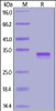 SARS-CoV-2 S protein RBD, His Tag on SDS-PAGE under reducing (R) condition. The gel was stained overnight with Coomassie Blue. The purity of the protein is greater than 95%.