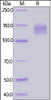 Rabbit LDL R, Fc Tag on SDS-PAGE under reducing (R) condition. The gel was stained overnight with Coomassie Blue. The purity of the protein is greater than 90%.