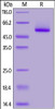 Rhesus macaque Properdin, His Tag on SDS-PAGE under reducing (R) condition. The gel was stained overnight with Coomassie Blue. The purity of the protein is greater than 95%.