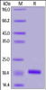 Human Iba1, His Tag on SDS-PAGE under reducing (R) condition. The gel was stained overnight with Coomassie Blue. The purity of the protein is greater than 95%.