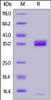 Human Apolipoprotein E, His Tag on SDS-PAGE under reducing (R) condition. The gel was stained overnight with Coomassie Blue. The purity of the protein is greater than 90%.