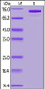 Human C2, His Tag (MALS verified) on SDS-PAGE under reducing (R) condition. The gel was stained overnight with Coomassie Blue. The purity of the protein is greater than 90%.
