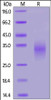 Human NKG2D, His Tag on SDS-PAGE under reducing (R) condition. The gel was stained overnight with Coomassie Blue. The purity of the protein is greater than 90%.