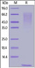 Human Mucin-1 (890-1158) , His Tag on SDS-PAGE under reducing (R) condition. The gel was stained overnight with Coomassie Blue. The purity of the protein is greater than 90%.