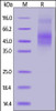 Cynomolgus Axl, His Tag on SDS-PAGE under reducing (R) condition. The gel was stained overnight with Coomassie Blue. The purity of the protein is greater than 90%.