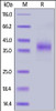 Human NKp46, His Tag on SDS-PAGE under reducing (R) condition. The gel was stained overnight with Coomassie Blue. The purity of the protein is greater than 90%.