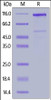 Human LRP-6 (20-630) , Mouse IgG2a Fc Tag on SDS-PAGE under reducing (R) condition. The gel was stained overnight with Coomassie Blue. The purity of the protein is greater than 90%.