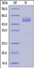 Human NKG2D, Fc Tag (HPLC-verified) on SDS-PAGE under reducing (R) condition. The gel was stained overnight with Coomassie Blue. The purity of the protein is greater than 90%.