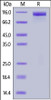 Human Her2, Mouse IgG2a Fc Tag on SDS-PAGE under reducing (R) condition. The gel was stained overnight with Coomassie Blue. The purity of the protein is greater than 95%.