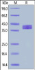 Human C5a, Fc Tag on SDS-PAGE under reducing (R) condition. The gel was stained overnight with Coomassie Blue. The purity of the protein is greater than 90%.