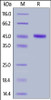 Human CBLB, His Tag on SDS-PAGE under reducing (R) condition. The gel was stained overnight with Coomassie Blue. The purity of the protein is greater than 95%.