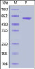 Human VSIG3, Fc Tag on SDS-PAGE under reducing (R) condition. The gel was stained overnight with Coomassie Blue. The purity of the protein is greater than 95%.