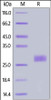 Human IL-33, His Tag on SDS-PAGE under reducing (R) condition. The gel was stained overnight with Coomassie Blue. The purity of the protein is greater than 95%.