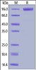 Human Flt-3, Fc Tag on SDS-PAGE under reducing (R) condition. The gel was stained overnight with Coomassie Blue. The purity of the protein is greater than 95%.