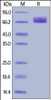 Human PDGF R alpha, His Tag on SDS-PAGE under reducing (R) condition. The gel was stained overnight with Coomassie Blue. The purity of the protein is greater than 95%.