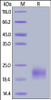 Human IL-5, His Tag on SDS-PAGE under reducing (R) condition. The gel was stained overnight with Coomassie Blue. The purity of the protein is greater than 90%.