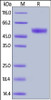 Human CD94, Mouse IgG2a Fc Tag on SDS-PAGE under reducing (R) condition. The gel was stained overnight with Coomassie Blue. The purity of the protein is greater than 95%.